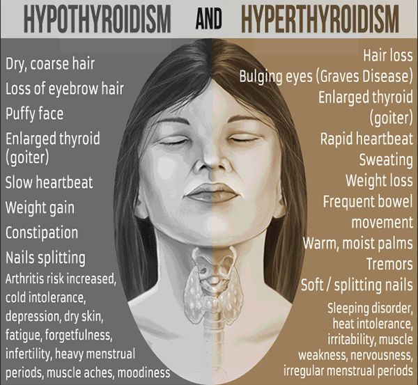 Unmasking Your Thyroid: Raising Thyroid Disorder Awareness
